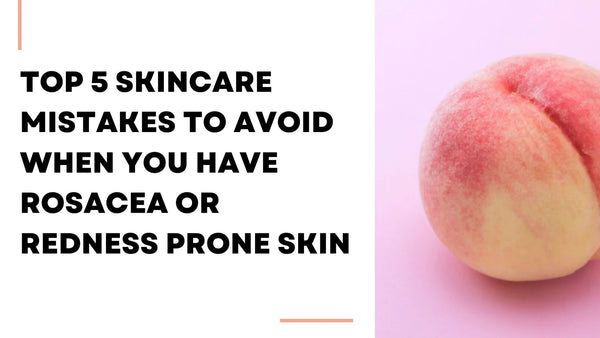 Top 5 Skincare Mistakes To Avoid When You Have Rosacea Or Redness Prone Skin